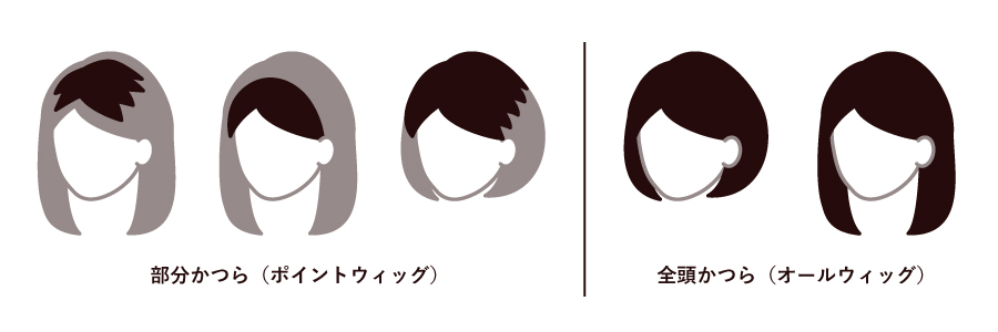 部分かつら（ポイントウィッグ）・全頭かつら（オールウィッグ）